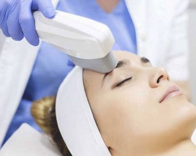 IPL and Laser Treatments